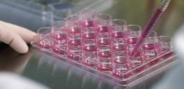 Breast Cancer Research - Stem Cells