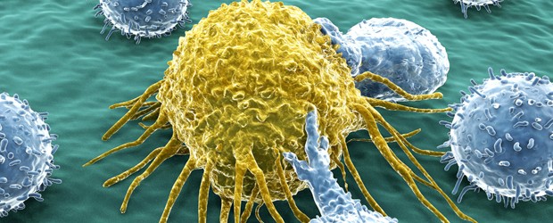 Uncovering Clues to the Spread of Cancer