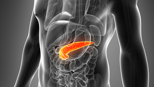 Could Bacterial Infections be the Cause of Pancreatic Cancer?